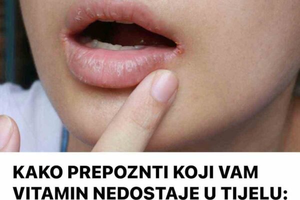 KAKO PREPOZNTI KOJI VAM VITAMIN NEDOSTAJE U TIJELU: Samo obratite pažnju na ove ZNAKOVE