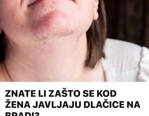 EVO ZAŠTO ŽENE IMAJU DLAKAVU BRADU: Ovo vam organizam govori!