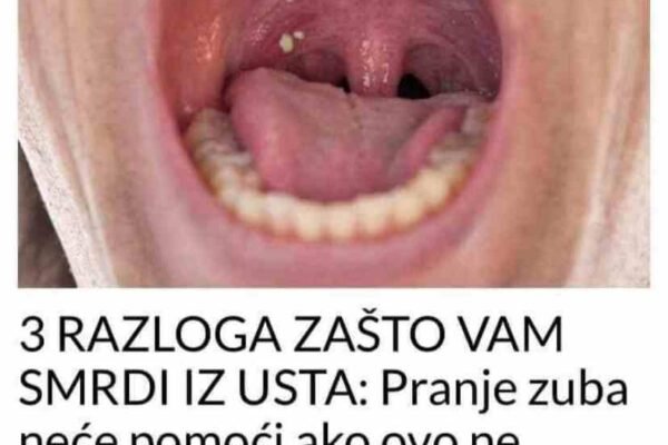 OVO SU 3 RAZLOGA ZAŠTO VAM SMRDI IZ USTA: Pranje zuba neće pomoći ako ovo ne riješite, EVO ŠTA JE U PITANJU