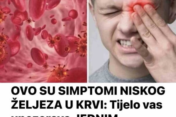 OVO SU SIMPTOMI NISKOG ŽELJEZA U KRVI: Tijelo vas upozorava JEDNIM SIMPTOMOM – ODMAH REAGUJTE