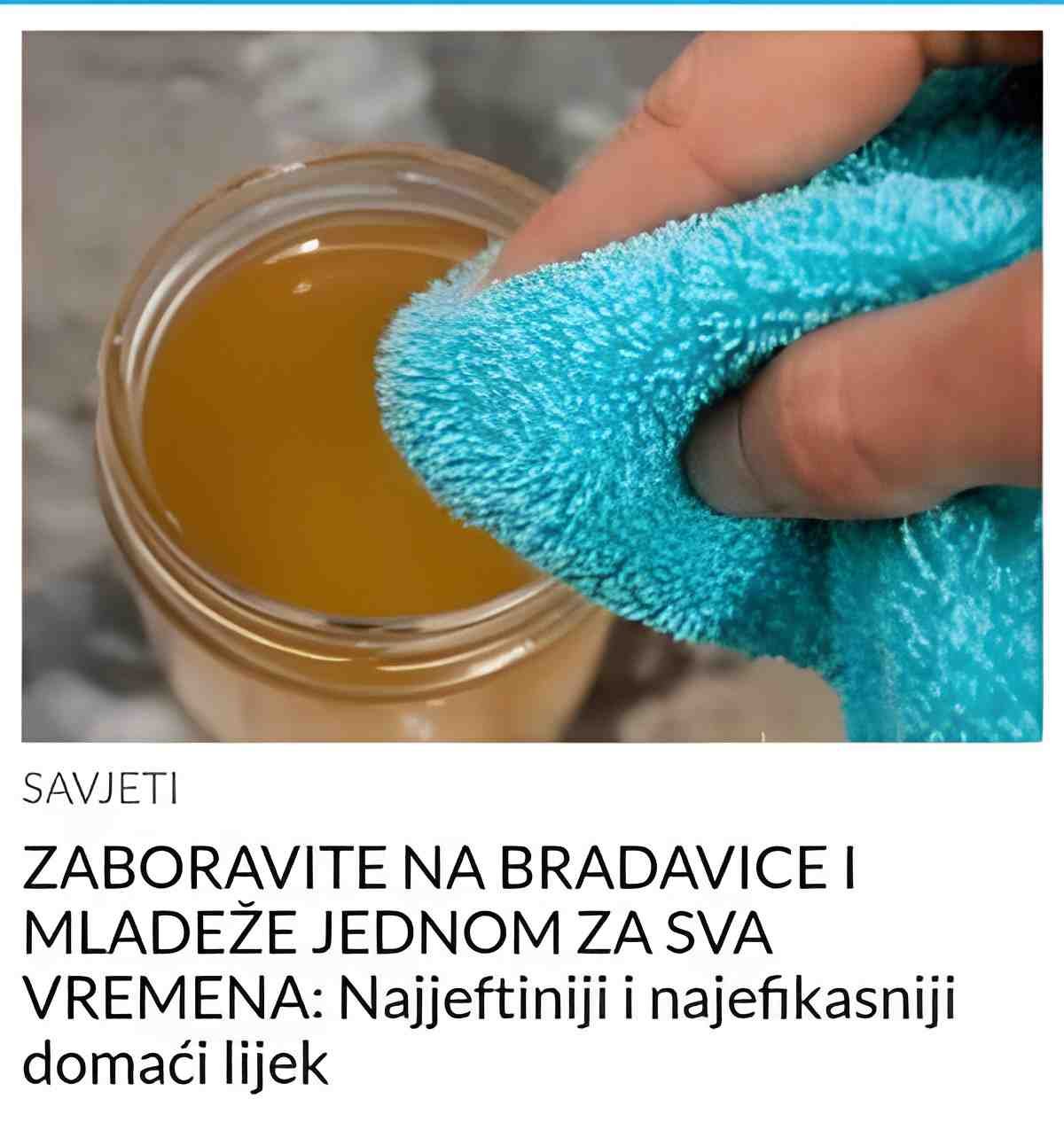 ZABORAVITE NA BRADAVICE I MLADEŽE JEDNOM ZA SVA VREMENA: Najjeftiniji i najefikasniji domaći lijek