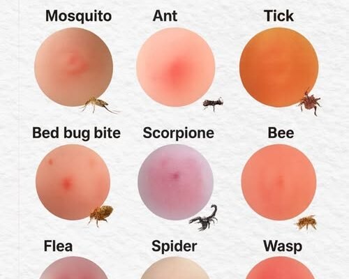 Sve Što Trebate Znati o Ujedima Insekata: Praktični Vodič 🐝🕷️