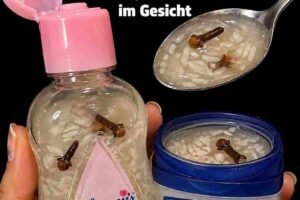 # **DIY-Kollagencreme mit Nelken, Babyöl & Reis** ## **Für geschmeidige, intensiv gepflegte und strahlende Haut** Mit zunehmendem Alter verlangsamt sich die natürliche Kollagenproduktion der Haut. Dadurch können feine Linien, Trockenheit und ein Verlust an Spannkraft entstehen. Neben fertigen Pflegeprodukten lässt sich auch zu Hause eine reichhaltige Hautpflege herstellen. Diese DIY-Creme kombiniert Nelken, Babyöl und Reispulver mit Aloe Vera, Vitamin E, Honig, Mandelöl und Rosenwasser. Die Inhaltsstoffe versorgen die Haut mit Feuchtigkeit, schützen sie vor oxidativem Stress und unterstützen ein geschmeidiges, gepflegtes Hautbild. --- # Zutaten *(Ergibt ca. 50 g Creme)* * 2 TL ganze Nelken, leicht zerdrückt * 3 EL unparfümiertes Babyöl * 1 EL fein gemahlenes Reispulver * 1 EL frisches Aloe-Vera-Gel * 1 Vitamin-E-Kapsel (ca. 400 IE) * 1 TL roher Honig * 1 TL kaltgepresstes Mandelöl * 1 TL Rosenwasser * ¼ TL Kurkumapulver (optional) --- # Zubereitung ### 1. Nelkenöl herstellen Das Babyöl in einem Wasserbad auf etwa **50 °C** erwärmen. Die zerdrückten Nelken hinzufügen und etwa **20 Minuten** ziehen lassen. Anschließend das Öl durch ein feines Sieb filtern und leicht abkühlen lassen. ### 2. Reispaste vorbereiten Das Reispulver mit **1 EL warmem destilliertem Wasser** zu einer glatten Paste verrühren. Dadurch verbindet sich das Pulver später besser mit dem Öl. ### 3. Creme herstellen Das warme Nelkenöl langsam unter ständigem Rühren zur Reispaste geben. So lange verrühren, bis eine cremige Konsistenz entsteht. ### 4. Weitere Zutaten hinzufügen Sobald die Mischung auf unter **40 °C** abgekühlt ist, Aloe Vera, Honig, Vitamin E, Mandelöl, Rosenwasser und optional Kurkuma gründlich einrühren. ### 5. Aufbewahrung Die fertige Creme in ein sauberes, desinfiziertes Glas füllen, beschriften und im Kühlschrank aufbewahren. Innerhalb von **zwei Monaten** verbrauchen. --- # Anwendung * Vor der ersten Anwendung einen **Patch-Test** durchführen und 24 Stunden abwarten. * Abends nach der Gesichtsreinigung eine kleine Menge auf Gesicht und Hals auftragen. * Die Augenpartie aussparen. * Mit sanften, aufwärts gerichteten Bewegungen etwa **eine Minute** einmassieren. * Zunächst drei Abende pro Woche anwenden. Bei guter Verträglichkeit kann die Creme täglich verwendet werden. * Die Creme immer mit sauberen Händen oder einem Spatel entnehmen. --- # Mögliche Vorteile * Spendet intensive und langanhaltende Feuchtigkeit. * Unterstützt eine weiche und geschmeidige Haut. * Antioxidantien aus Nelken, Vitamin E und Kurkuma helfen dabei, die Haut vor freien Radikalen zu schützen. * Reispulver kann zu einem ebenmäßigeren und strahlenderen Hautbild beitragen. * Aloe Vera und Rosenwasser wirken beruhigend und pflegend. * Mandelöl unterstützt die Hautbarriere und hinterlässt ein angenehmes Hautgefühl. * Die Creme zieht gut ein und verleiht der Haut ein gepflegtes, natürliches Strahlen. --- # Hinweis Regelmäßige Anwendung ist entscheidend. Viele Menschen bemerken nach mehreren Wochen eine verbesserte Hautfeuchtigkeit und ein gepflegteres Hautbild. Das Ergebnis kann jedoch je nach Hauttyp unterschiedlich ausfallen. Diese DIY-Creme ersetzt keine medizinische Behandlung. Bei empfindlicher Haut oder bekannten Allergien sollte vor der Anwendung ein Hautverträglichkeitstest durchgeführt werden.