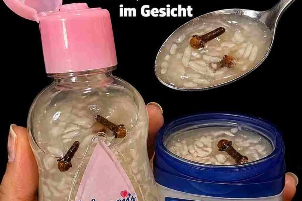 # **DIY-Kollagencreme mit Nelken, Babyöl & Reis** ## **Für geschmeidige, intensiv gepflegte und strahlende Haut** Mit zunehmendem Alter verlangsamt sich die natürliche Kollagenproduktion der Haut. Dadurch können feine Linien, Trockenheit und ein Verlust an Spannkraft entstehen. Neben fertigen Pflegeprodukten lässt sich auch zu Hause eine reichhaltige Hautpflege herstellen. Diese DIY-Creme kombiniert Nelken, Babyöl und Reispulver mit Aloe Vera, Vitamin E, Honig, Mandelöl und Rosenwasser. Die Inhaltsstoffe versorgen die Haut mit Feuchtigkeit, schützen sie vor oxidativem Stress und unterstützen ein geschmeidiges, gepflegtes Hautbild. --- # Zutaten *(Ergibt ca. 50 g Creme)* * 2 TL ganze Nelken, leicht zerdrückt * 3 EL unparfümiertes Babyöl * 1 EL fein gemahlenes Reispulver * 1 EL frisches Aloe-Vera-Gel * 1 Vitamin-E-Kapsel (ca. 400 IE) * 1 TL roher Honig * 1 TL kaltgepresstes Mandelöl * 1 TL Rosenwasser * ¼ TL Kurkumapulver (optional) --- # Zubereitung ### 1. Nelkenöl herstellen Das Babyöl in einem Wasserbad auf etwa **50 °C** erwärmen. Die zerdrückten Nelken hinzufügen und etwa **20 Minuten** ziehen lassen. Anschließend das Öl durch ein feines Sieb filtern und leicht abkühlen lassen. ### 2. Reispaste vorbereiten Das Reispulver mit **1 EL warmem destilliertem Wasser** zu einer glatten Paste verrühren. Dadurch verbindet sich das Pulver später besser mit dem Öl. ### 3. Creme herstellen Das warme Nelkenöl langsam unter ständigem Rühren zur Reispaste geben. So lange verrühren, bis eine cremige Konsistenz entsteht. ### 4. Weitere Zutaten hinzufügen Sobald die Mischung auf unter **40 °C** abgekühlt ist, Aloe Vera, Honig, Vitamin E, Mandelöl, Rosenwasser und optional Kurkuma gründlich einrühren. ### 5. Aufbewahrung Die fertige Creme in ein sauberes, desinfiziertes Glas füllen, beschriften und im Kühlschrank aufbewahren. Innerhalb von **zwei Monaten** verbrauchen. --- # Anwendung * Vor der ersten Anwendung einen **Patch-Test** durchführen und 24 Stunden abwarten. * Abends nach der Gesichtsreinigung eine kleine Menge auf Gesicht und Hals auftragen. * Die Augenpartie aussparen. * Mit sanften, aufwärts gerichteten Bewegungen etwa **eine Minute** einmassieren. * Zunächst drei Abende pro Woche anwenden. Bei guter Verträglichkeit kann die Creme täglich verwendet werden. * Die Creme immer mit sauberen Händen oder einem Spatel entnehmen. --- # Mögliche Vorteile * Spendet intensive und langanhaltende Feuchtigkeit. * Unterstützt eine weiche und geschmeidige Haut. * Antioxidantien aus Nelken, Vitamin E und Kurkuma helfen dabei, die Haut vor freien Radikalen zu schützen. * Reispulver kann zu einem ebenmäßigeren und strahlenderen Hautbild beitragen. * Aloe Vera und Rosenwasser wirken beruhigend und pflegend. * Mandelöl unterstützt die Hautbarriere und hinterlässt ein angenehmes Hautgefühl. * Die Creme zieht gut ein und verleiht der Haut ein gepflegtes, natürliches Strahlen. --- # Hinweis Regelmäßige Anwendung ist entscheidend. Viele Menschen bemerken nach mehreren Wochen eine verbesserte Hautfeuchtigkeit und ein gepflegteres Hautbild. Das Ergebnis kann jedoch je nach Hauttyp unterschiedlich ausfallen. Diese DIY-Creme ersetzt keine medizinische Behandlung. Bei empfindlicher Haut oder bekannten Allergien sollte vor der Anwendung ein Hautverträglichkeitstest durchgeführt werden.
